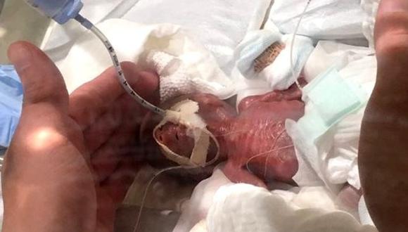 En esta imagen el bebé tenía cinco días de nacido. Foto: KEIO UNIVERSITY HOSPITAL