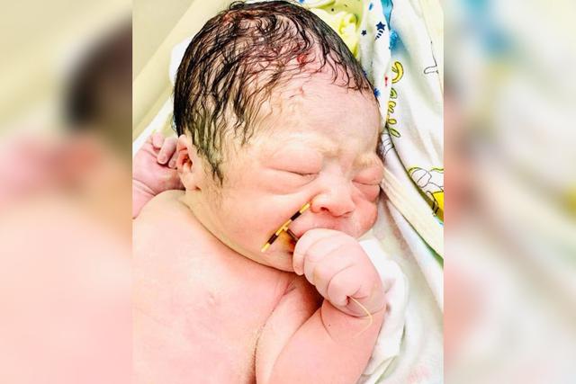 Foto 1 de 3 | El bebé nació sosteniendo el dispositivo intrauterino entre sus manos. Hecho que generó sorpresa entre los internautas. | Foto: Hospital Hai Phong. (Desliza hacia la izquierda para ver más fotos).