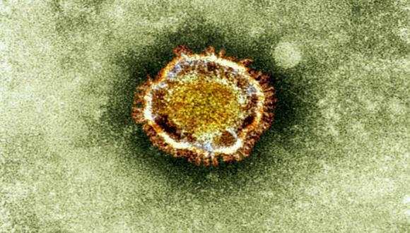 Esta imagen proviene de la Agencia Británica para la Protección Sanitaria y muestra a un coronavirus bajo el microscopio. (Foto: AP)