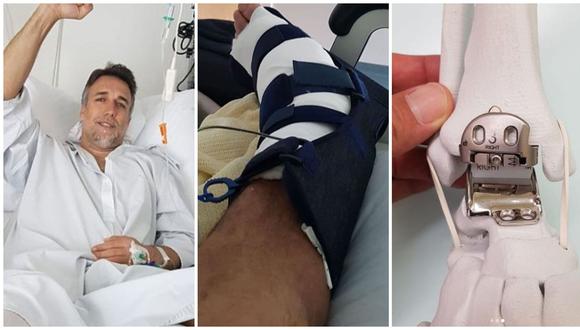 Batistuta luego de salir del quirófano: "La prótesis en el tobillo izquierdo ya es una realidad". (Foto: Twitter Batistuta)