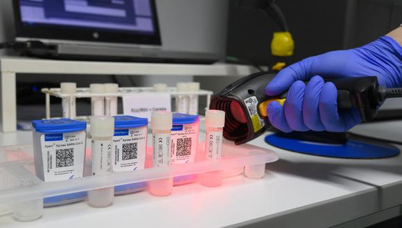 Un miembro del personal médico escanea los códigos de las pruebas rápidas de SARS-Cov 2 en el laboratorio de PCR del Hospital Robert Bosch en Stuttgart, en el sur de Alemania, el 2 de febrero de 2022 en medio de la actual pandemia de coronavirus. (Foto de THOMAS KIENZLE / AFP)