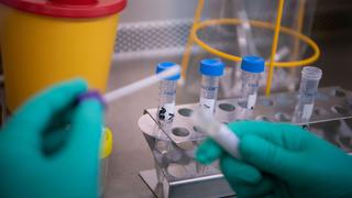 Apeseg sobre pruebas de coronavirus en clínicas privadas: “No sirven absolutamente para nada”