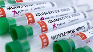 Chile decreta alerta sanitaria tras confirmar seis casos de viruela del mono