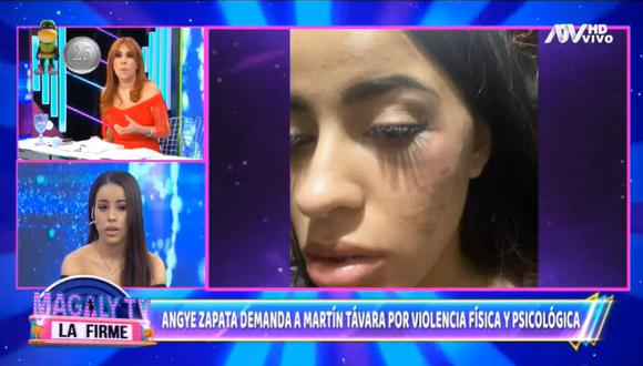 Angye Zapata denunció a Martín Távara por violencia física y psicológica y presenta nueva prueba. (Foto: Captura)