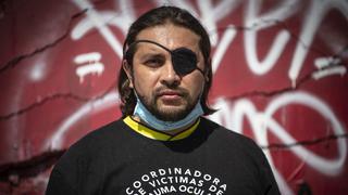 Un ojo de la cara, el alto precio de un año de estallido social en Chile | FOTOS