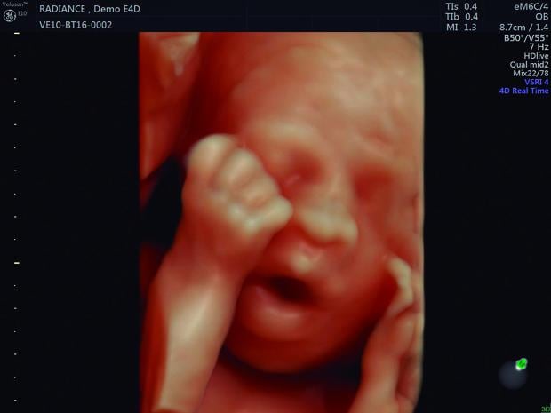 Ecografías 5D o 4D HDlive: imágenes súper realistas de tu bebé
