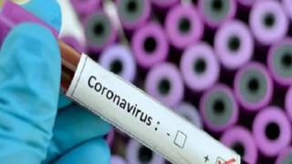 Coronavirus en Perú: Minsa confirma 9 nuevos casos de COVID-19 y cifra se eleva a 60 en Arequipa