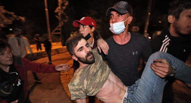 Un manifestante palestino herido recibe ayuda durante los enfrentamientos con la policía israelí en Sheikh Jarrah, en el este de Jerusalén. (Foto: AFP / EMMANUEL DUNAND).