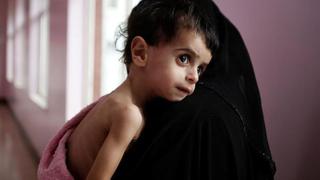 Hambruna en Yemen: Alimentos no pueden llegar tras 18 meses