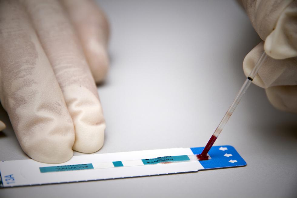 La epidemia del VIH afecta a unos 37 millones de personas en todos el mundo. (Foto: AFP)