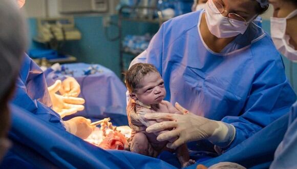 Isabela nació el pasado 13 de febrero y dos días después el fotógrafo encargado de inmortalizar el nacimiento compartió las fotos en sus redes sociales (Foto: Rodrigo Kunstmann)