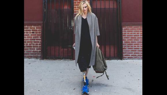 Instagram: modelo de Vogue pierde una pierna por tampón