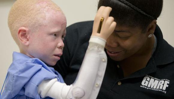 EE.UU.: Los niños albinos que escaparon de la muerte en África