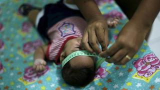 Estudio confirmaría que el zika causa microcefalia