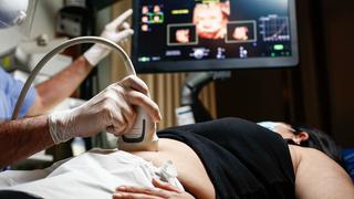 De las ecografías 2D al 7D: el estudio del embarazo es más preciso e intuitivo con la Inteligencia Artificial