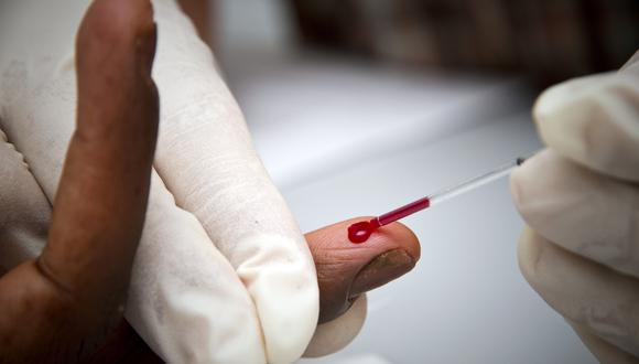 La prueba necesita solo una gota de sangre de la yema de los dedos. (Foto: Jody AMIET / AFP)