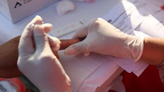 Minsa: más de un millón de personas se han hecho prueba de VIH en lo que va del año