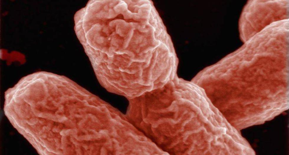 La resistencia de las bacterias ha aumentado en los últimos años. (Foto: Getty Images) 