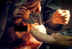 ¿Por qué se incrementa el número de cirugías plásticas en el mundo?