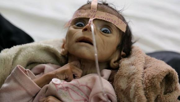 El bebé que murió de hambre a los 5 meses en Yemen