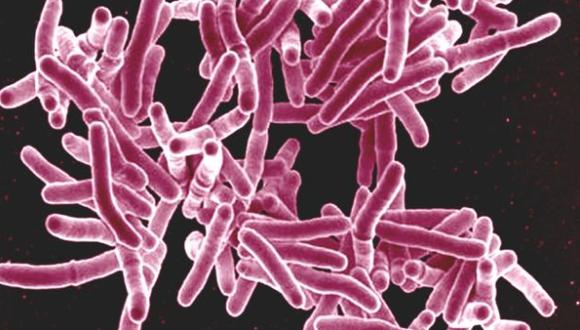 La tuberculosis es subestimada por la OMS, según estudio