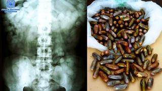 España: hallan 200 cápsulas con hachís en los estómagos de dos hombres