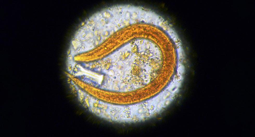 Un grupo de investigadores estadounidenses detectó el parásito Angiostrongylus cantonensis en residentes de cinco condados de Florida, que puede ser letal. (Foto: Flickr)