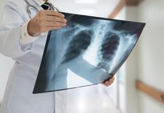 Salud | Revelan el mecanismo que hace que la tuberculosis sea tan peligrosa