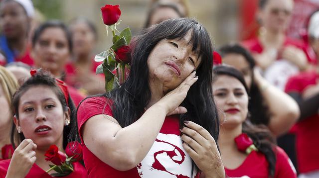 Colombianas quemadas con ácido marchan contra la violencia  - 1