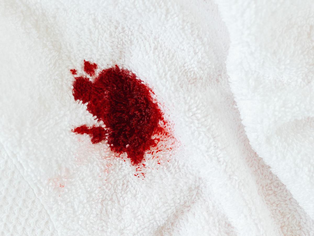Trucos caseros para eliminar manchas de sangre recientes de la ropa | | Hacks nnni | RESPUESTAS | MAG.