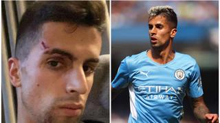 Joao Cancelo sufrió de un robo en su casa y fue agredido al intentar oponerse | FOTO