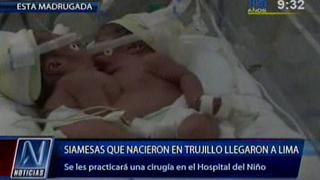 Siamesas nacidas en Trujillo son evaluadas en Hospital del Niño
