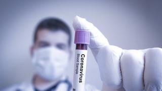 Coronavirus | ¿Podría el plasma sanguíneo de un convaleciente servir para tratar el COVID-19? 