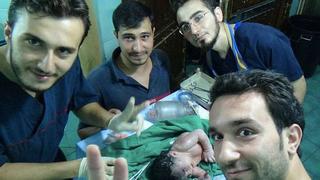 Médicos sirios salvan bebe que nació con metralla en la cabeza