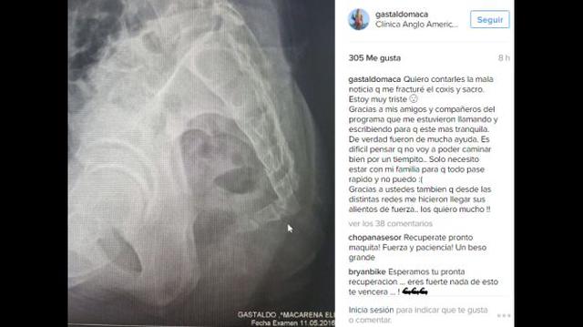 "Combate": Zumba ocasionó caída y lesión a Macarena Gastaldo - 2