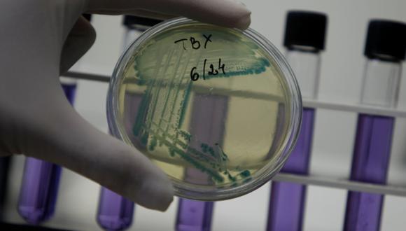 Proponen método para reducir bacteria 'E.coli' en alimentos