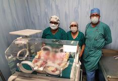 San Martín: nacen saludables trillizas en Hospital de Tocache durante el estado de emergencia