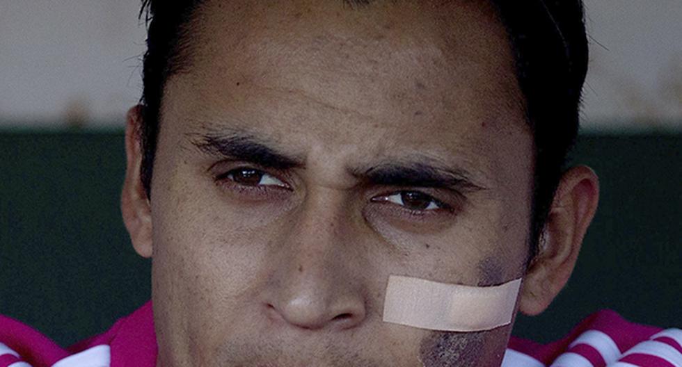 Keylor Navas es el portero titular del Real Madrid y de la Selección Costarricense de Fútbol. (Foto: Getty Images)