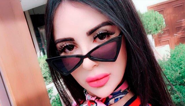 Joven gasta 500 mil dólares en cirugías para parecerse a Kim Kardashian pero termina con "labios de pescado". Su historia es viral en redes sociales. (Facebook)