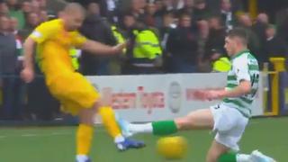 Jugador del Celtic borró su cuenta de Twitter luego de ser criticado por esta brutal falta que cometió | VIDEO