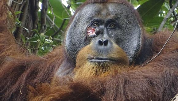 Fotografía del macho de orangután Rakus con una herida bajo el ojo. Rakus es un orangután macho de Sumatra (Pongo abelii) que sufrió una herida debajo de uno ojo y sobre la que se aplicó una planta de conocidas propiedades medicinales, un comportamiento que es la primera vez que se observa en un animal salvaje. EFE/ Armas / Suaq Project