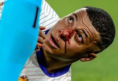 Ensangrentado: así quedó la nariz de Mbappé durante el Francia vs Austria por Eurocopa | VIDEO