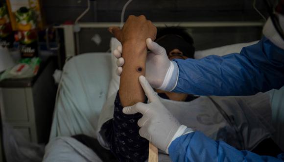 Las autoridades sanitarias están realizando la identificación de contactos sospechosos. (Foto: AFP)