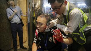 Activista prodemocracia pierde parte de la oreja en la protesta más violenta en Hong Kong | FOTOS
