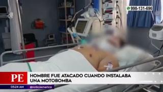 Callao: hombre resulta grave tras ser acuchillado en la cara y el cuerpo sin motivo aparente | VIDEO
