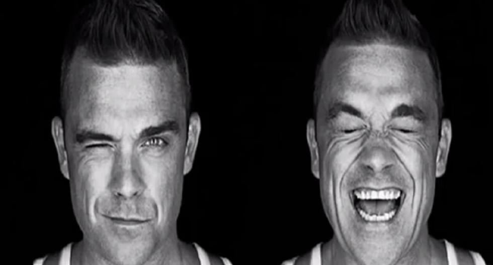 Robbie Williams confiesa que abusó del botox. (Foto: Instagram)