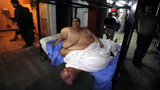 Murió el mexicano que llegó a ser el hombre más obeso del mundo