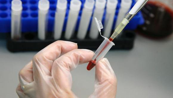 Cuba: detectan cepa de VIH que se desarrolla con mayor rapidez