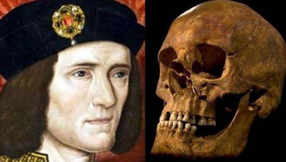 ¿Qué causó la muerte de Ricardo III?