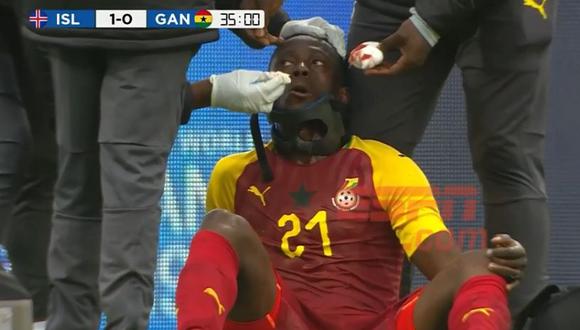 Algo insólito se vio en el amistoso entre las selecciones de Ghana e Islandia. El futbolista africano Emmanuel Boateng tenía el mencionado objeto. Entérate qué pasó. (Foto: captura)
